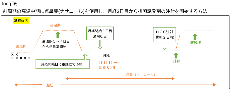 ロング法図