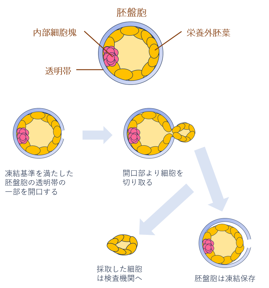 pgta流れ