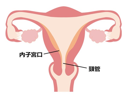 子宮卵管造影検査1